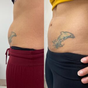 aqualyx fat 1