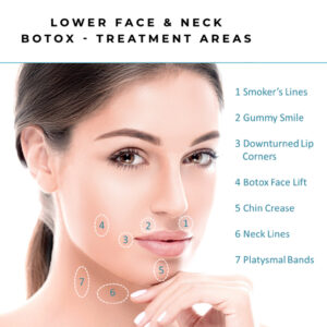 botox 3