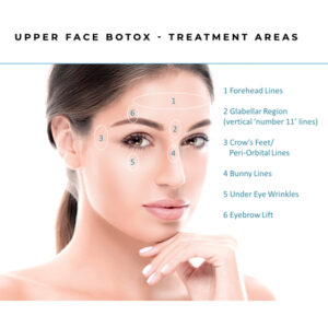 botox 4