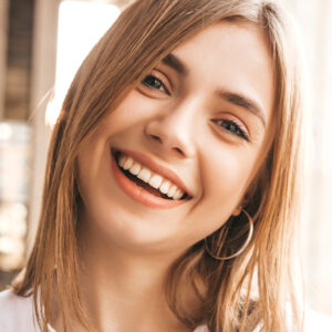 gummy smile 2