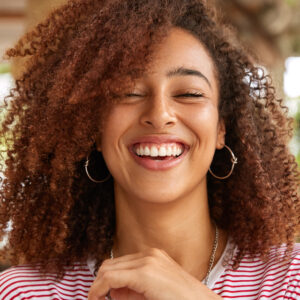 gummy smile 3